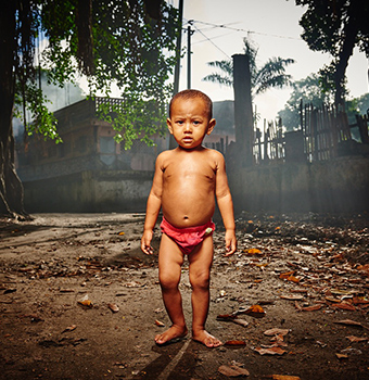 Mercy Ships Baby Feeding Program – Wandering Child – Matt Barnes Photography